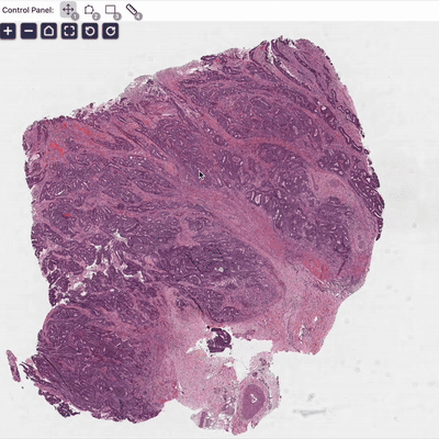 Real-time tissue classification