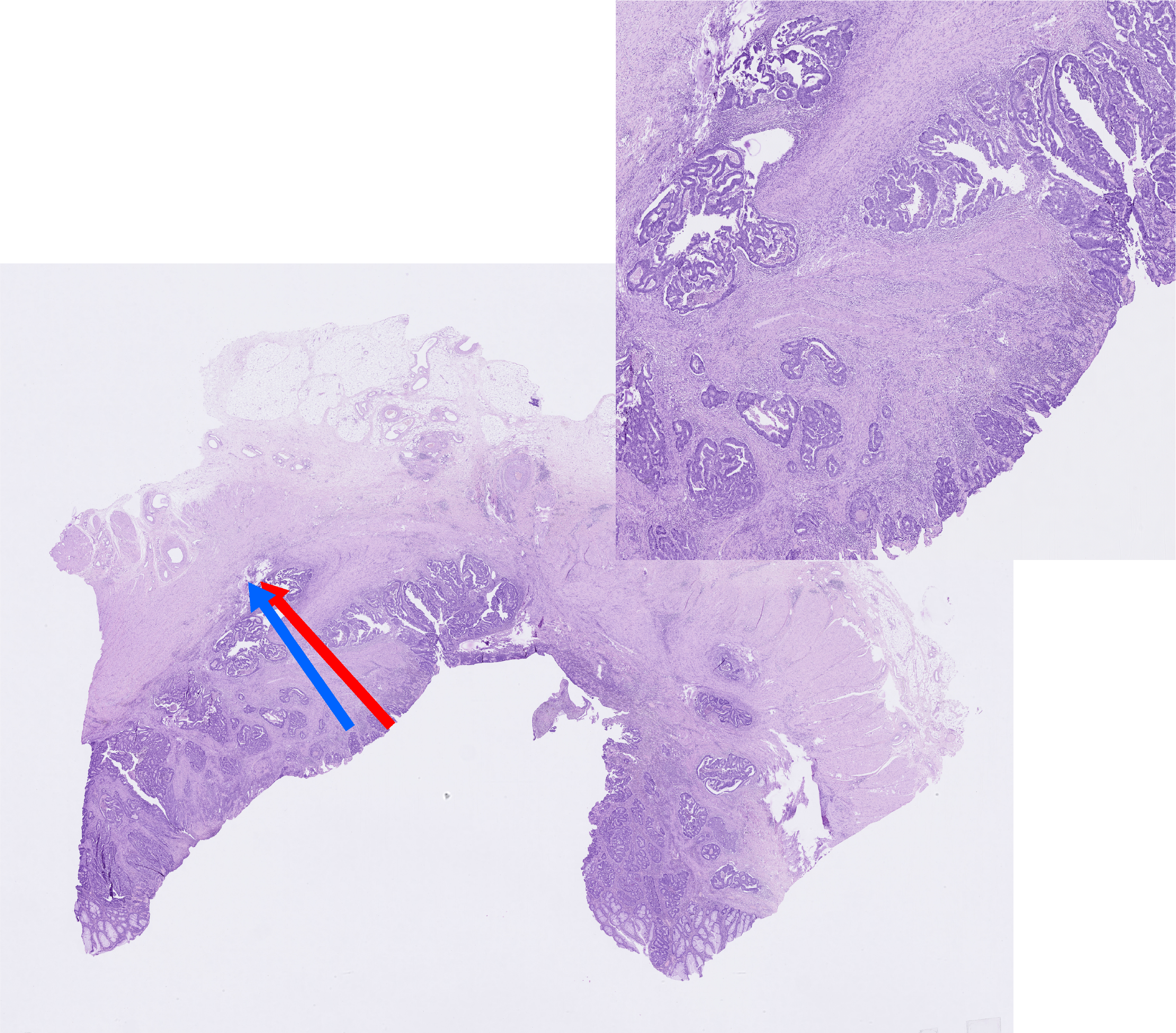 AI medical image analysis